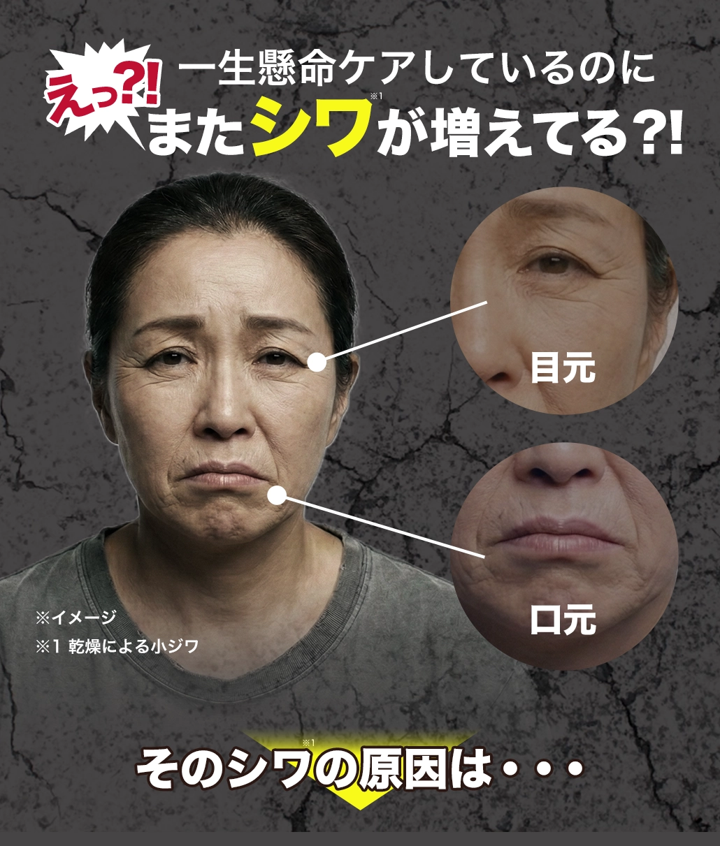 シワが増えてる？目元・口元のシワ